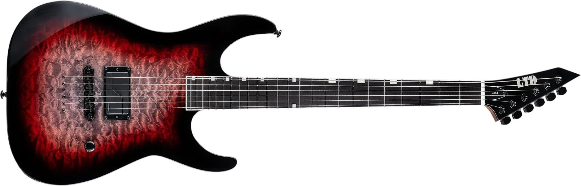 ESP