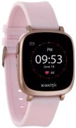 X-WATCH